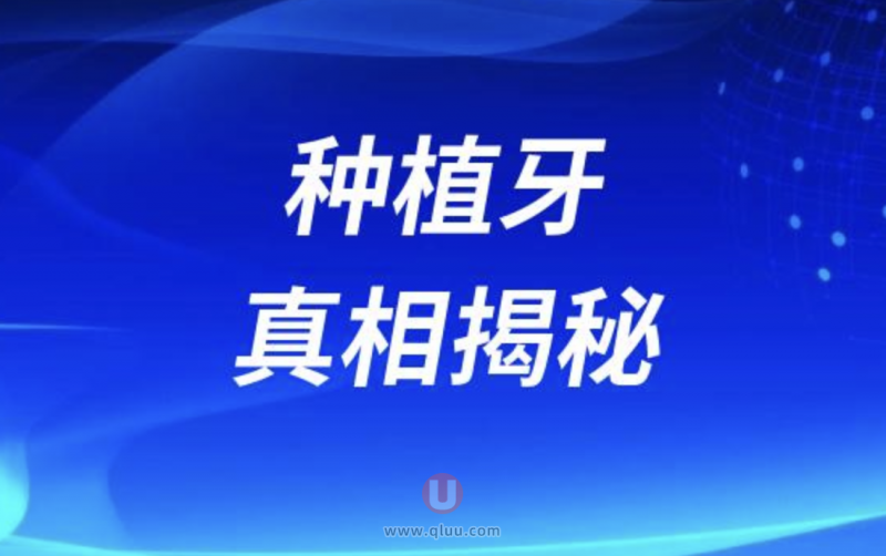 种植牙真相揭秘！避免陷阱让你明智选择！