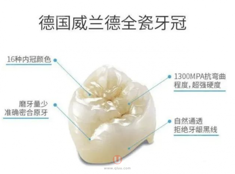 德国威兰德全瓷牙最新产品介绍