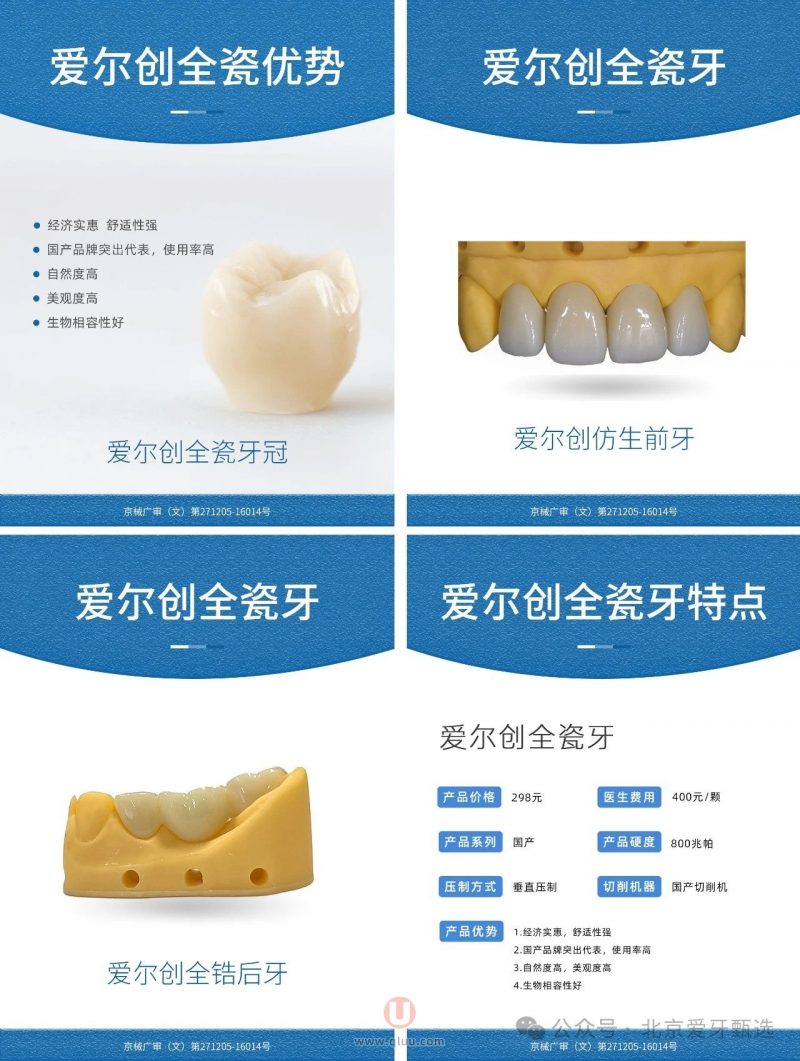 四大热门全瓷牙：拉瓦、威兰德、泽康、爱尔创牙冠详细介绍