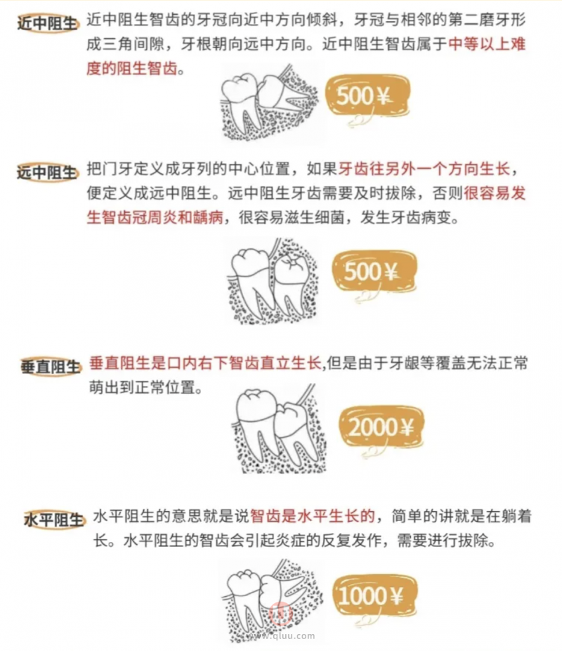 拔智齿牙多少钱一颗？可以用医保报销吗？