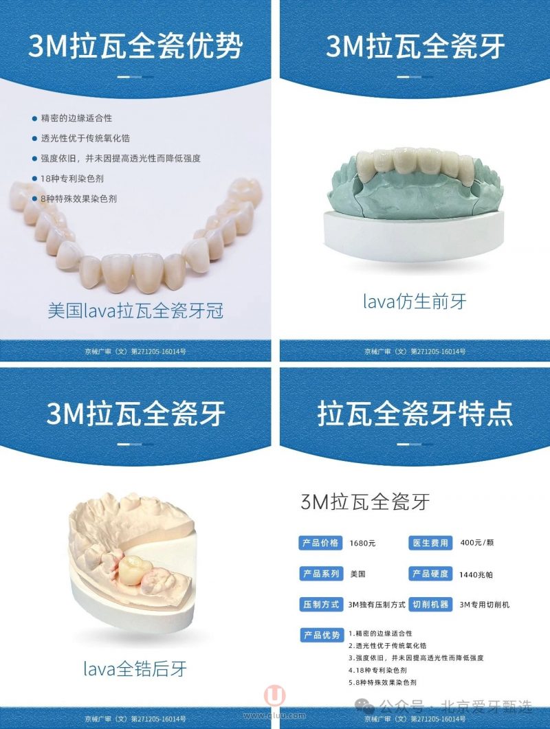 四大热门全瓷牙：拉瓦、威兰德、泽康、爱尔创牙冠详细介绍