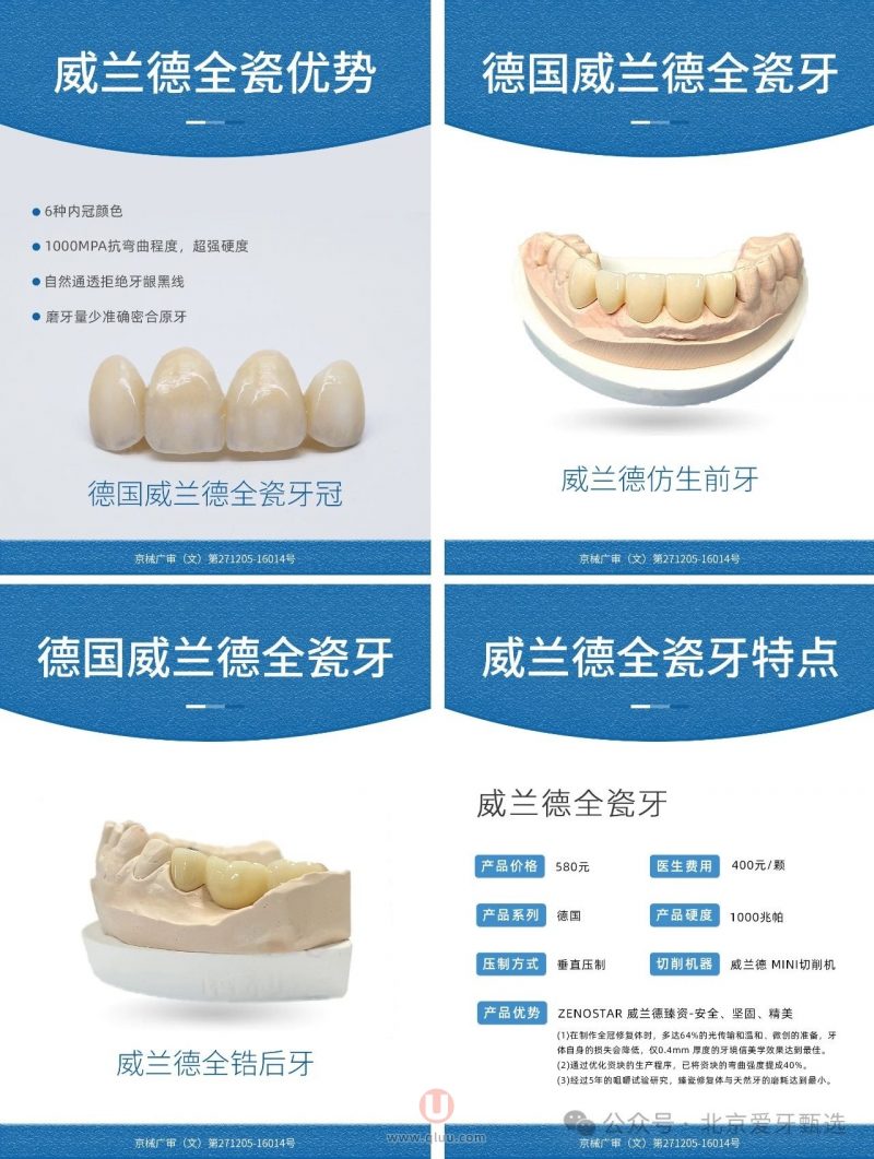 四大热门全瓷牙：拉瓦、威兰德、泽康、爱尔创牙冠详细介绍