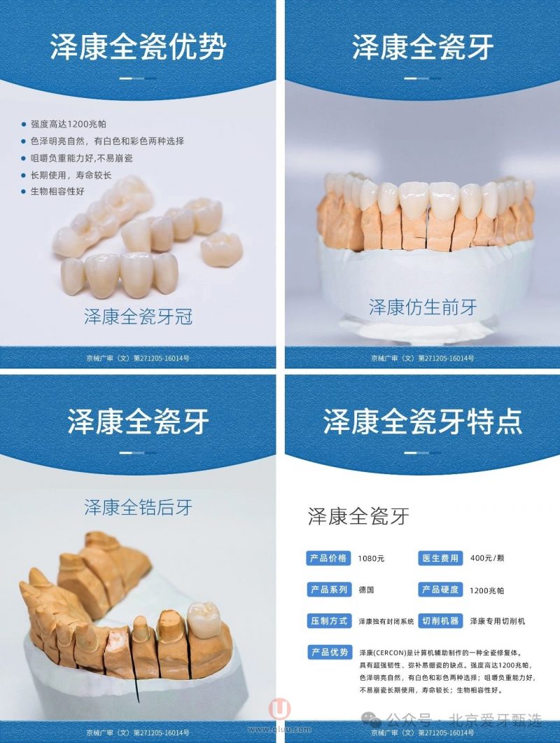 四大热门全瓷牙：拉瓦、威兰德、泽康、爱尔创牙冠详细介绍