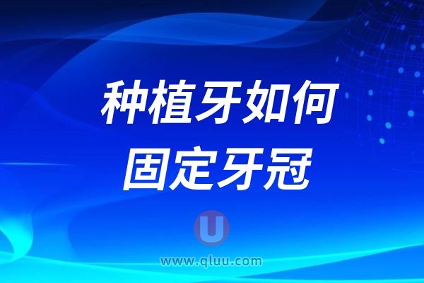 种植牙如何固定牙冠？种植牙固定方式有几种？