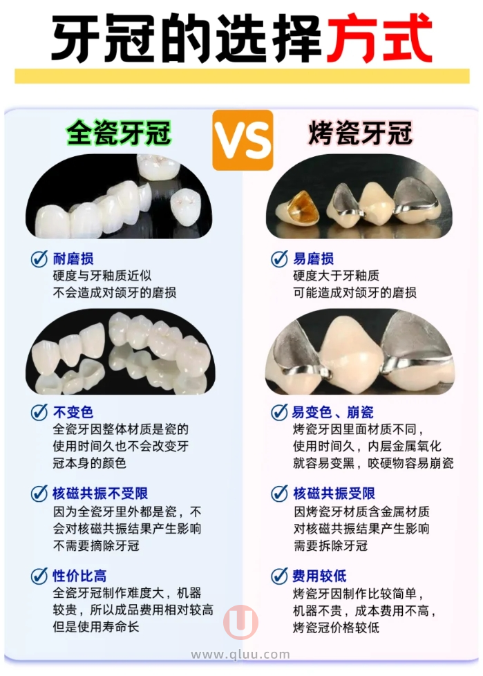 2024种植牙价目表分析盘点