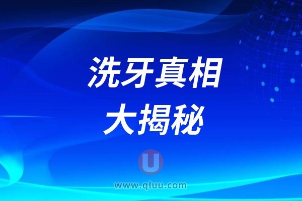 口腔牙医为何频繁推荐洗牙真相大揭秘