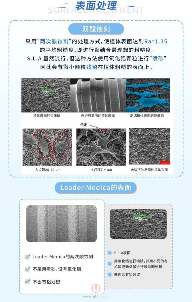 LM种植体是哪个国家的品牌？实力和档次怎么样？